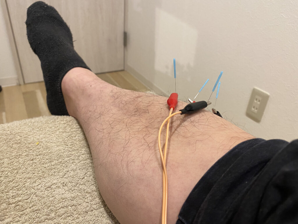電気鍼 鍼通電