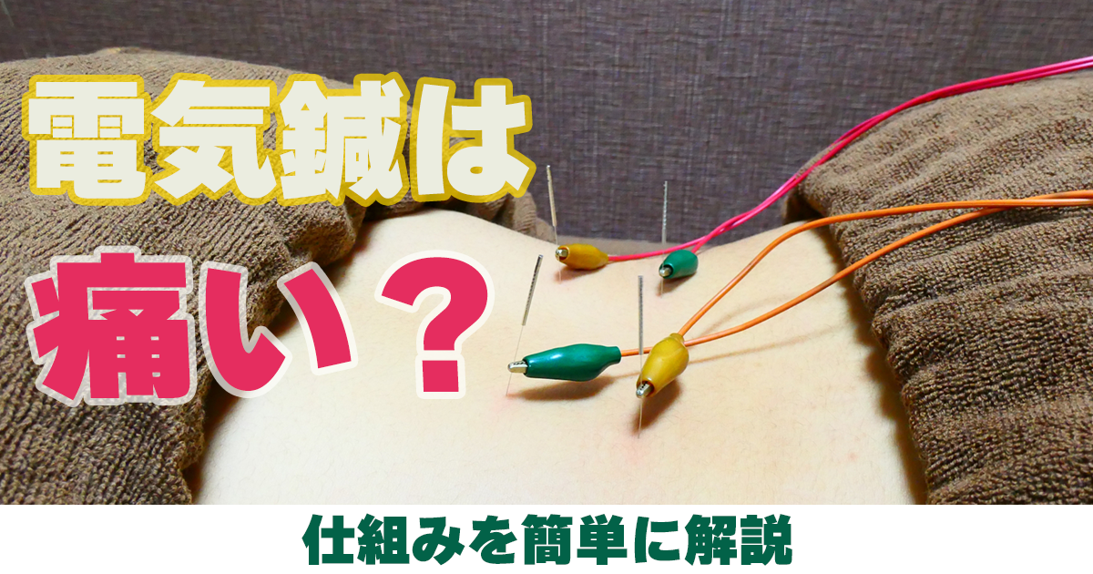 電気鍼は痛い?仕組みを簡単に解説